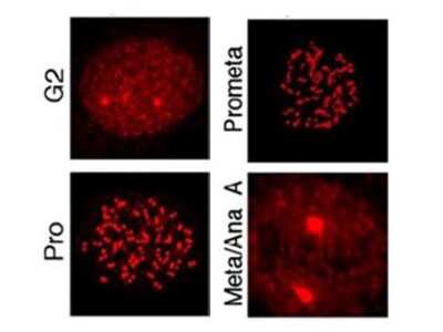 Immunohistochemistry: MLF1 Interacting Protein [p Thr78] Antibody [NBP1-77938]